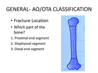 GENERAL- AO/OTA CLASSIFICATION
• Fracture Location
• Which part of the
bone?
1. Proximal end segment
2. Diaphyseal segment
3. Distal end segment
 