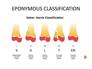 EPONYMOUS CLASSIFICATION
 
