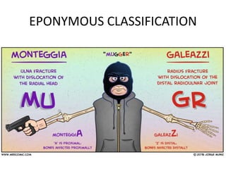 EPONYMOUS CLASSIFICATION
 