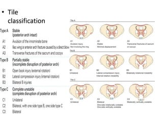 • Tile
classification
 