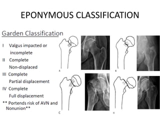 EPONYMOUS CLASSIFICATION
 