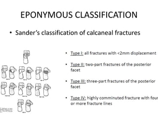 EPONYMOUS CLASSIFICATION
• Sander’s classification of calcaneal fractures
 