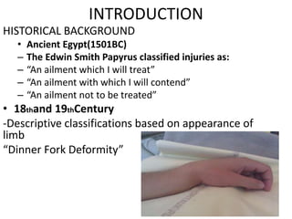 INTRODUCTION
HISTORICAL BACKGROUND
• Ancient Egypt(1501BC)
– The Edwin Smith Papyrus classified injuries as:
– “An ailment which I will treat”
– “An ailment with which I will contend”
– “An ailment not to be treated”
• 18thand 19thCentury
-Descriptive classifications based on appearance of
limb
“Dinner Fork Deformity”
 