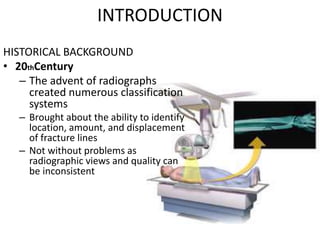 INTRODUCTION
HISTORICAL BACKGROUND
• 20thCentury
– The advent of radiographs
created numerous classification
systems
– Brought about the ability to identify
location, amount, and displacement
of fracture lines
– Not without problems as
radiographic views and quality can
be inconsistent
 