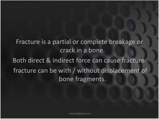 Fracture is a partial or complete breakage or 
crack in a bone. 
Both direct & indirect force can cause fracture. 
fracture can be with / without displacement of 
bone fragments. 
sriloy21@gmail.com 
 