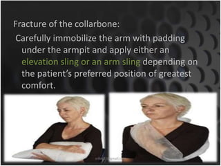 Fracture of the collarbone: 
Carefully immobilize the arm with padding 
under the armpit and apply either an 
elevation sling or an arm sling depending on 
the patient’s preferred position of greatest 
comfort. 
sriloy21@gmail.com 
 