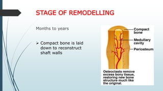 STAGE OF REMODELLING
Months to years
 Compact bone is laid
down to reconstruct
shaft walls
 