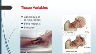Tissue Variables
 Cancellous or
cortical bones
 Bone necrosis
 Infection
 