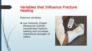 Variables that Influence Fracture
Healing
External variables
 Low Intensity Pulsed
Ultrasound (LIPUS)
•accelerates fracture
healing and increases
mechanical strength of
callus.
 