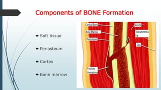 Components of BONE Formation
 Soft tissue
 Periosteum
 Cortex
 Bone marrow
 