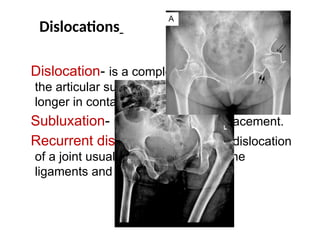 Dislocation Real Image Fracture and Dislocation.. human anatomy pcII.pptx
