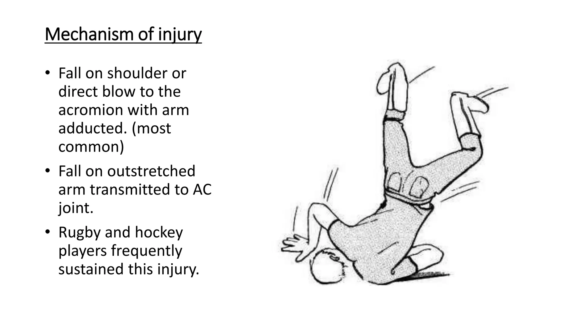 Mechanism of injury
• Fall on shoulder or
direct blow to the
acromion with arm
adducted. (most
common)
• Fall on outstretched
arm transmitted to AC
joint.
• Rugby and hockey
players frequently
sustained this injury.
 