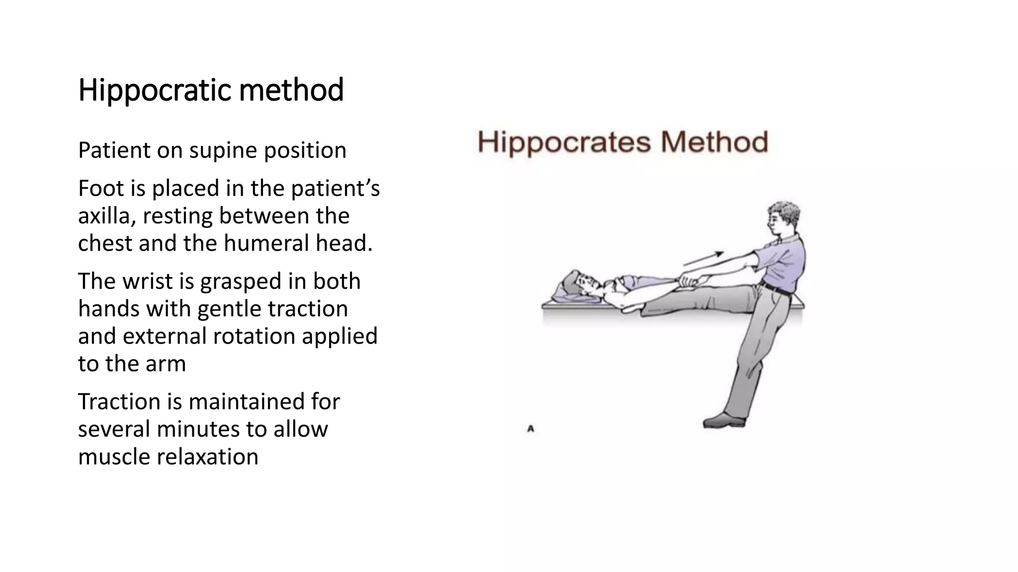 Hippocratic method
Patient on supine position
Foot is placed in the patient’s
axilla, resting between the
chest and the humeral head.
The wrist is grasped in both
hands with gentle traction
and external rotation applied
to the arm
Traction is maintained for
several minutes to allow
muscle relaxation
 