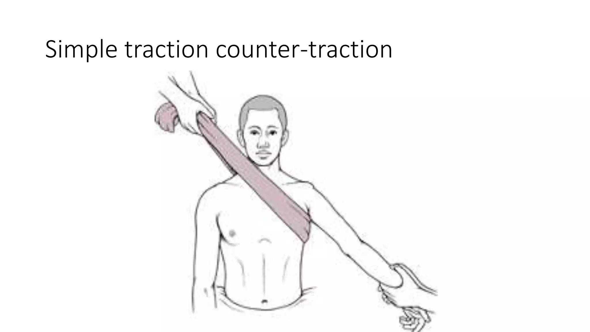 Simple traction counter-traction
 