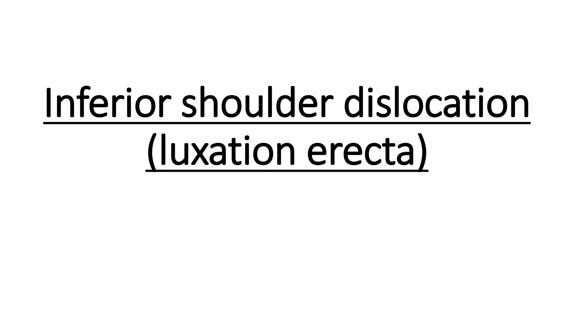 Inferior shoulder dislocation
(luxation erecta)
 