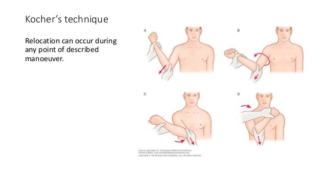 Fracture And Dislocation Of The Shoulder Girdle