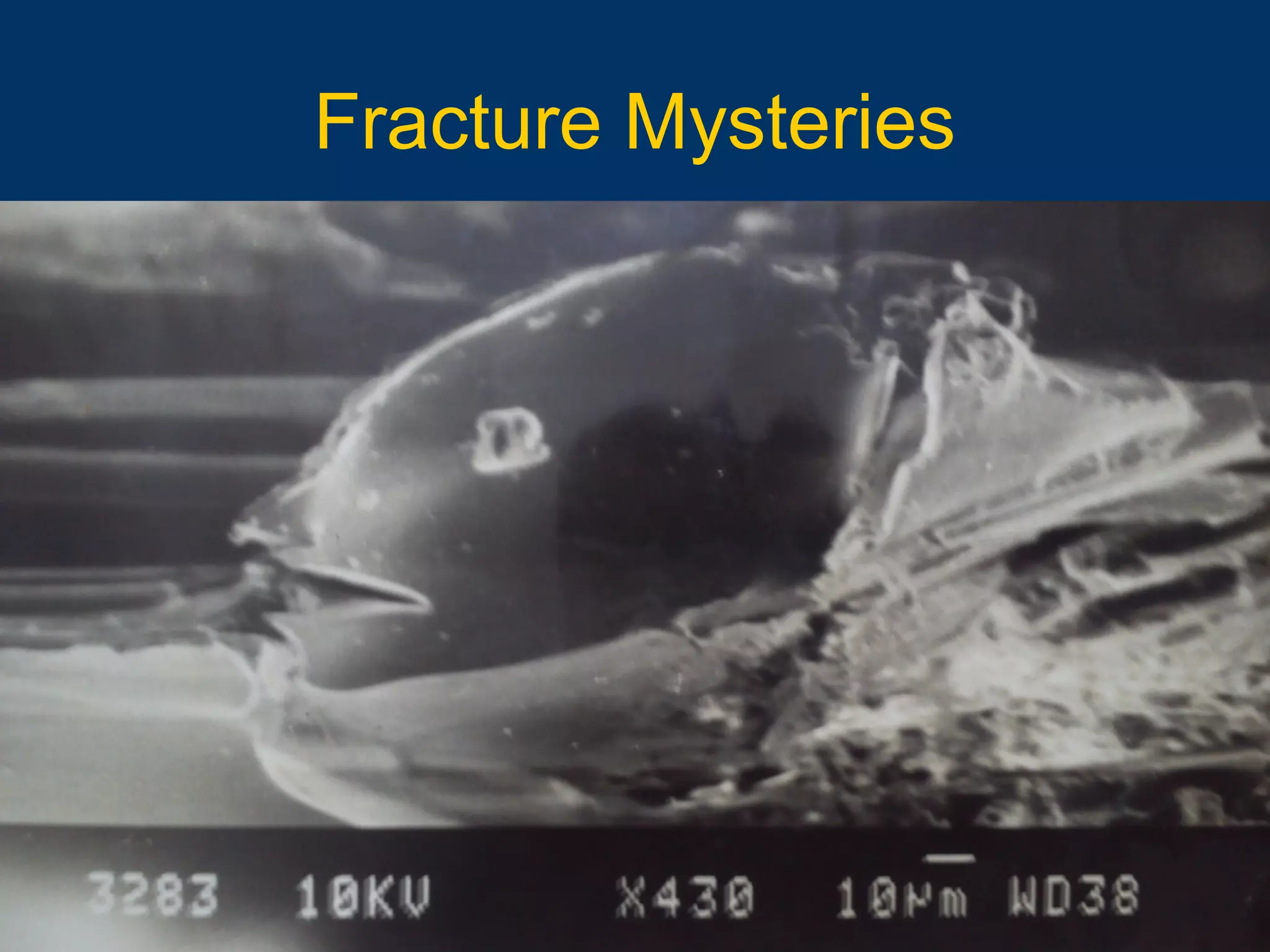 10/16/15 95
Fracture Mysteries
 