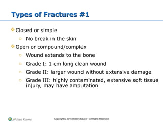 Fracture and sports injury.pptx ETIOLOGY AND DISEASES | PPTX