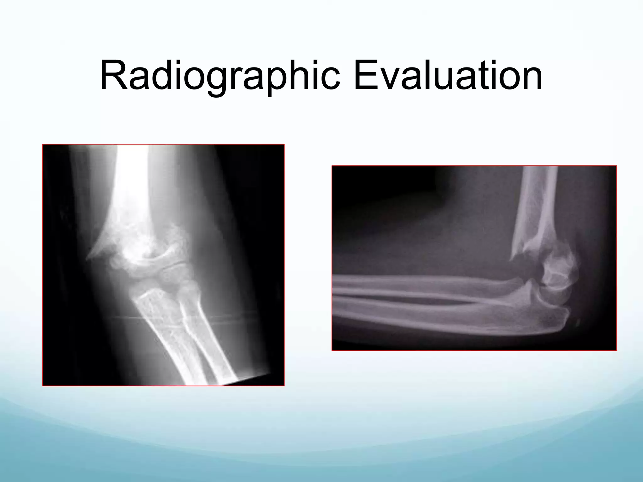 Radiographic Evaluation
 