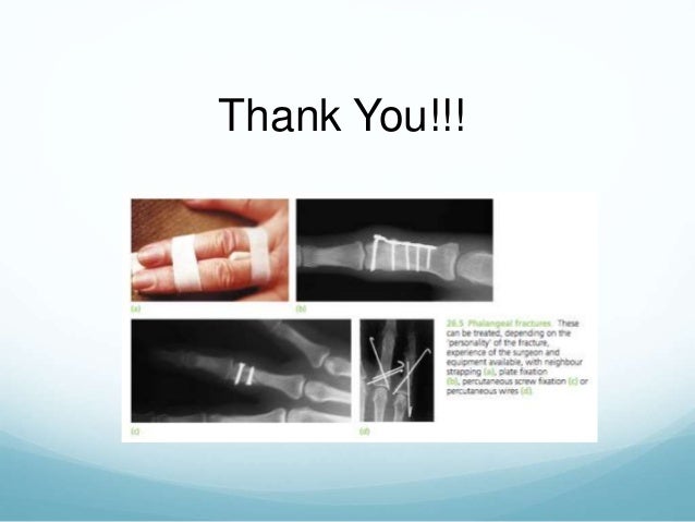 Fracture around elbow and hand