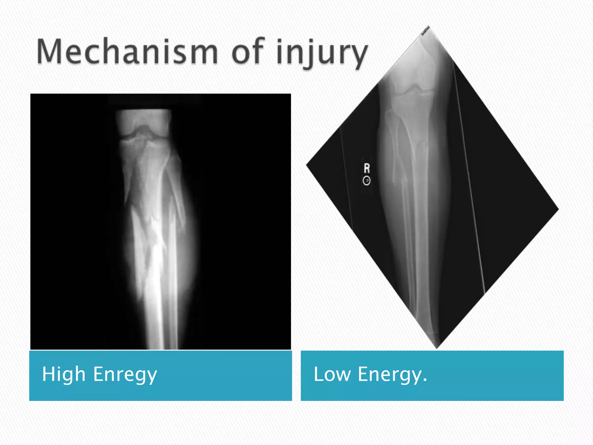 High Enregy

Low Energy.

 