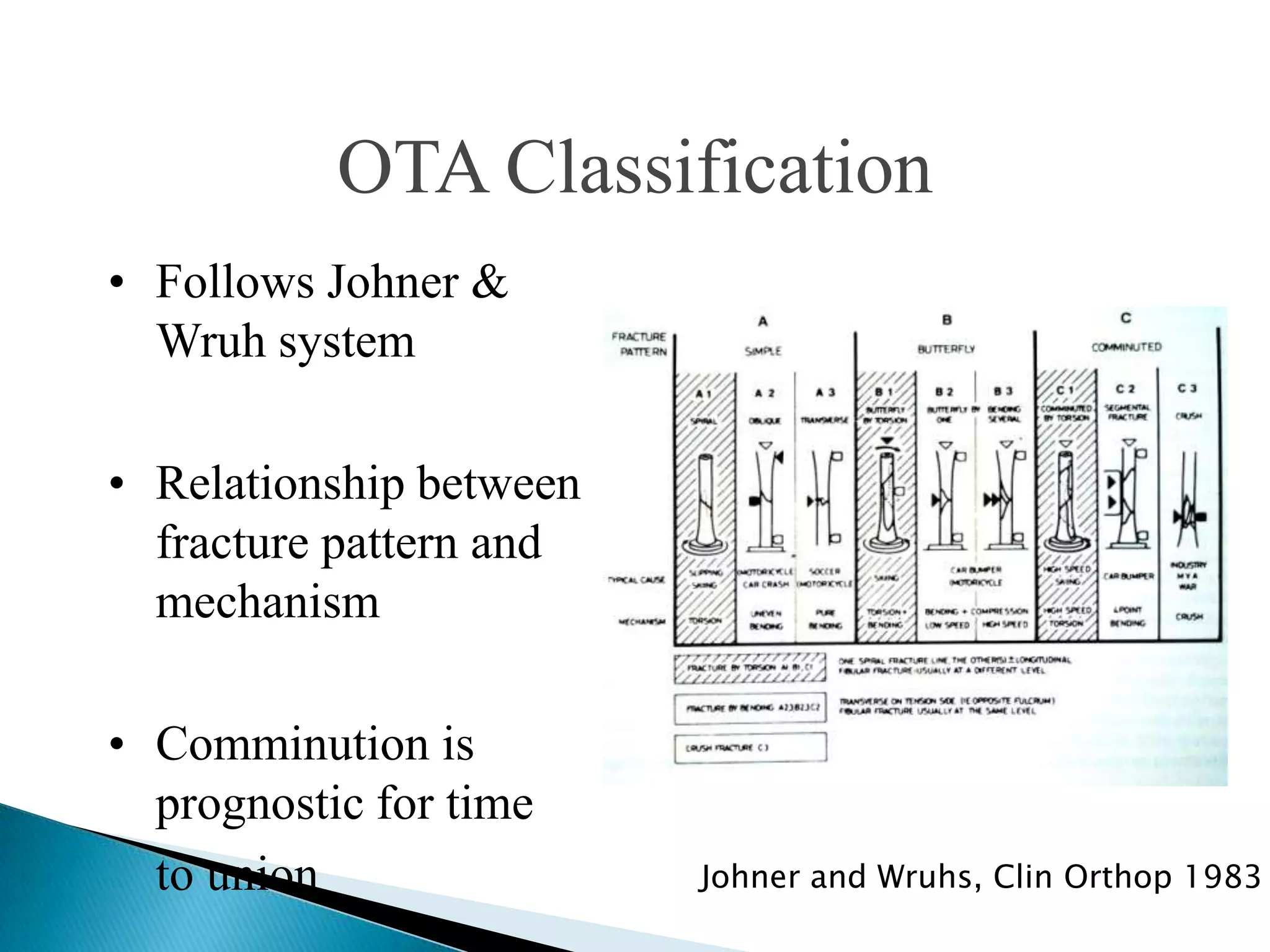 OTA Classification
• Follows Johner &
Wruh system
• Relationship between
fracture pattern and
mechanism
• Comminution is
prognostic for time
to union

Johner and Wruhs, Clin Orthop 1983

 