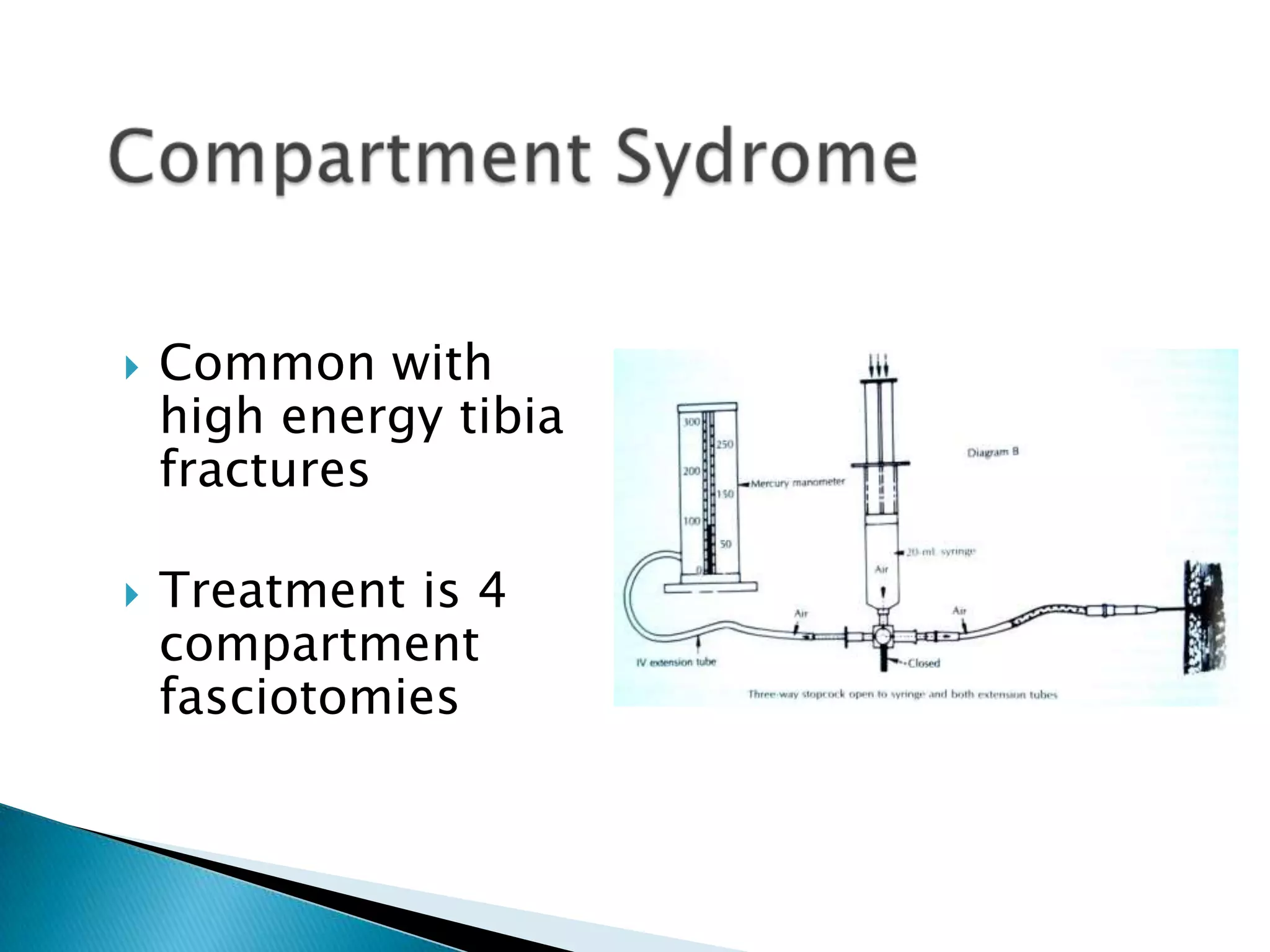 



Common with
high energy tibia
fractures
Treatment is 4
compartment
fasciotomies

 