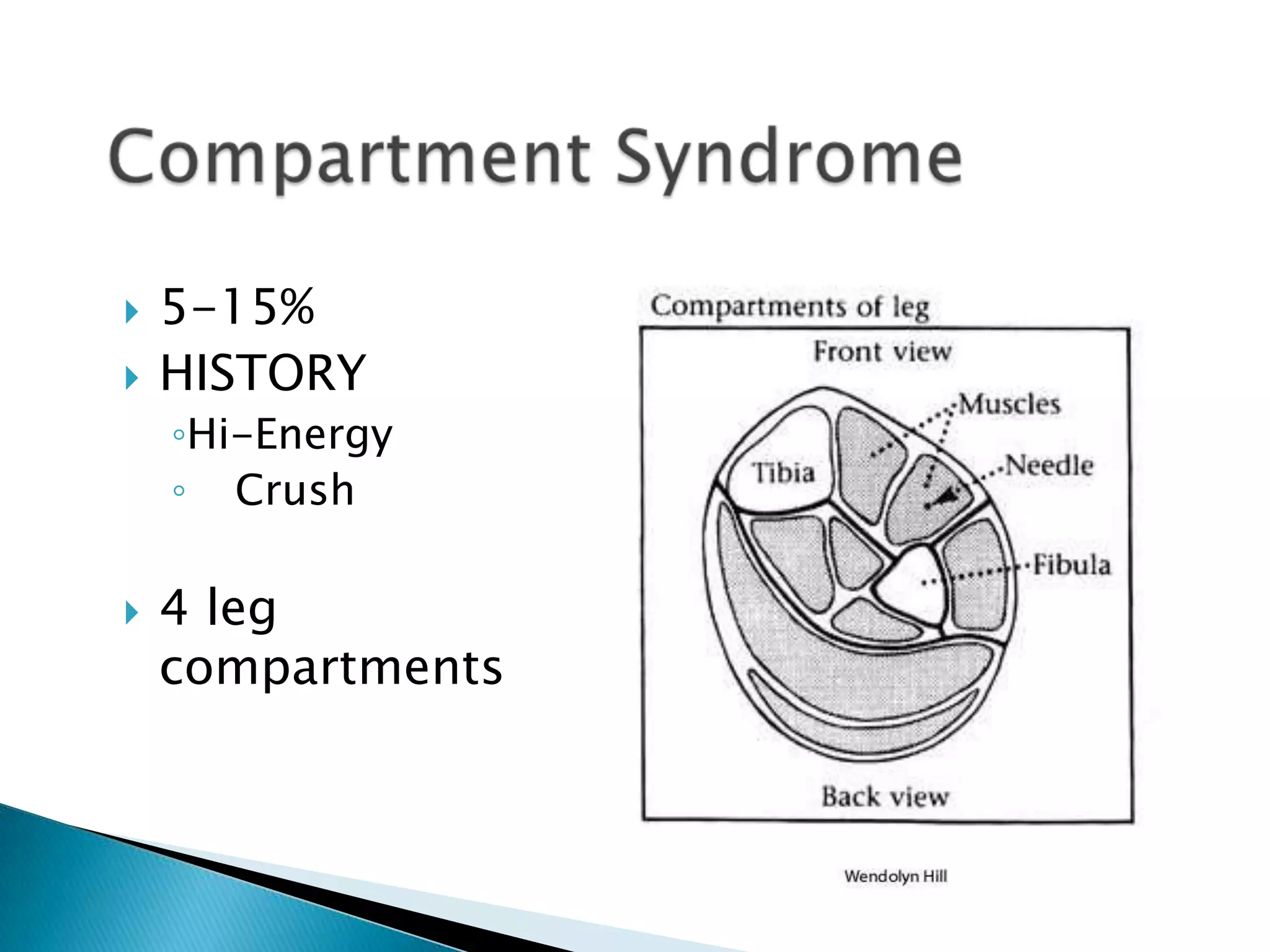 


5-15%
HISTORY
◦Hi-Energy
◦ Crush



4 leg
compartments

 