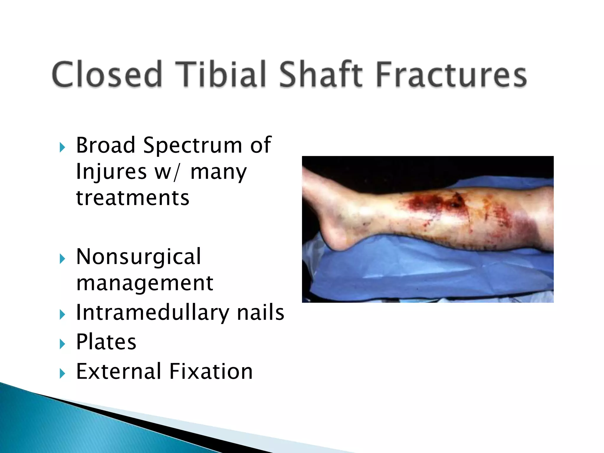 







Broad Spectrum of
Injures w/ many
treatments
Nonsurgical
management
Intramedullary nails
Plates
External Fixation

 