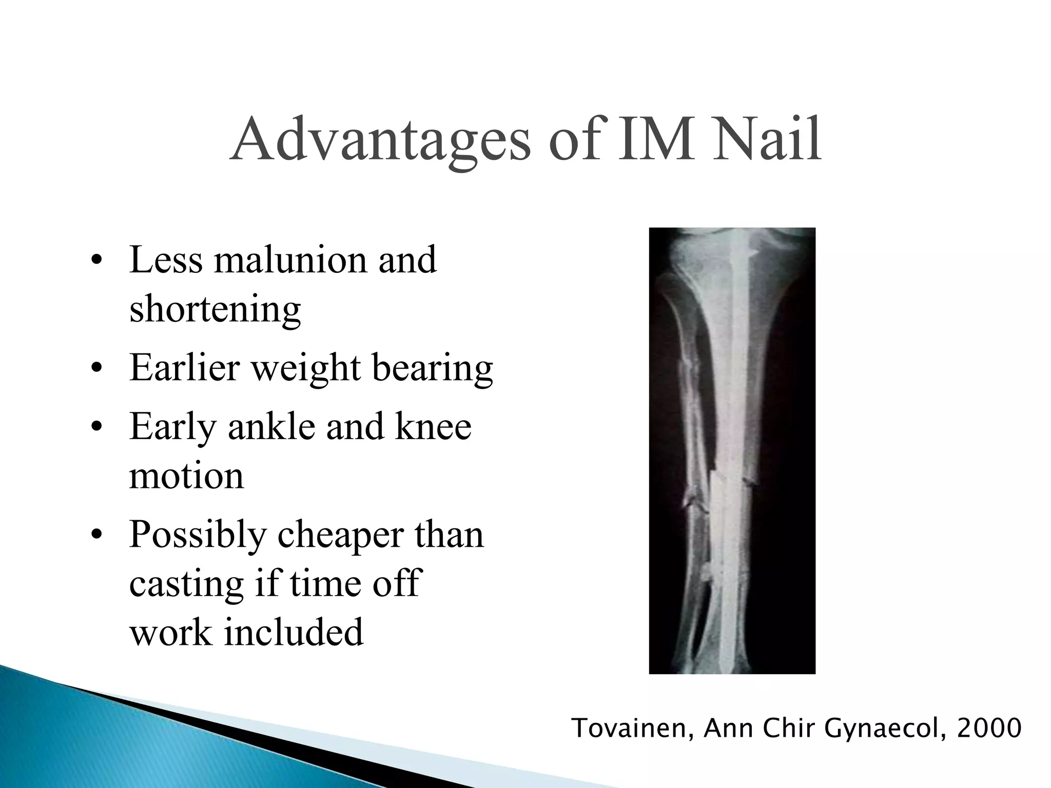 Advantages of IM Nail
• Less malunion and
shortening
• Earlier weight bearing
• Early ankle and knee
motion
• Possibly cheaper than
casting if time off
work included
Tovainen, Ann Chir Gynaecol, 2000

 