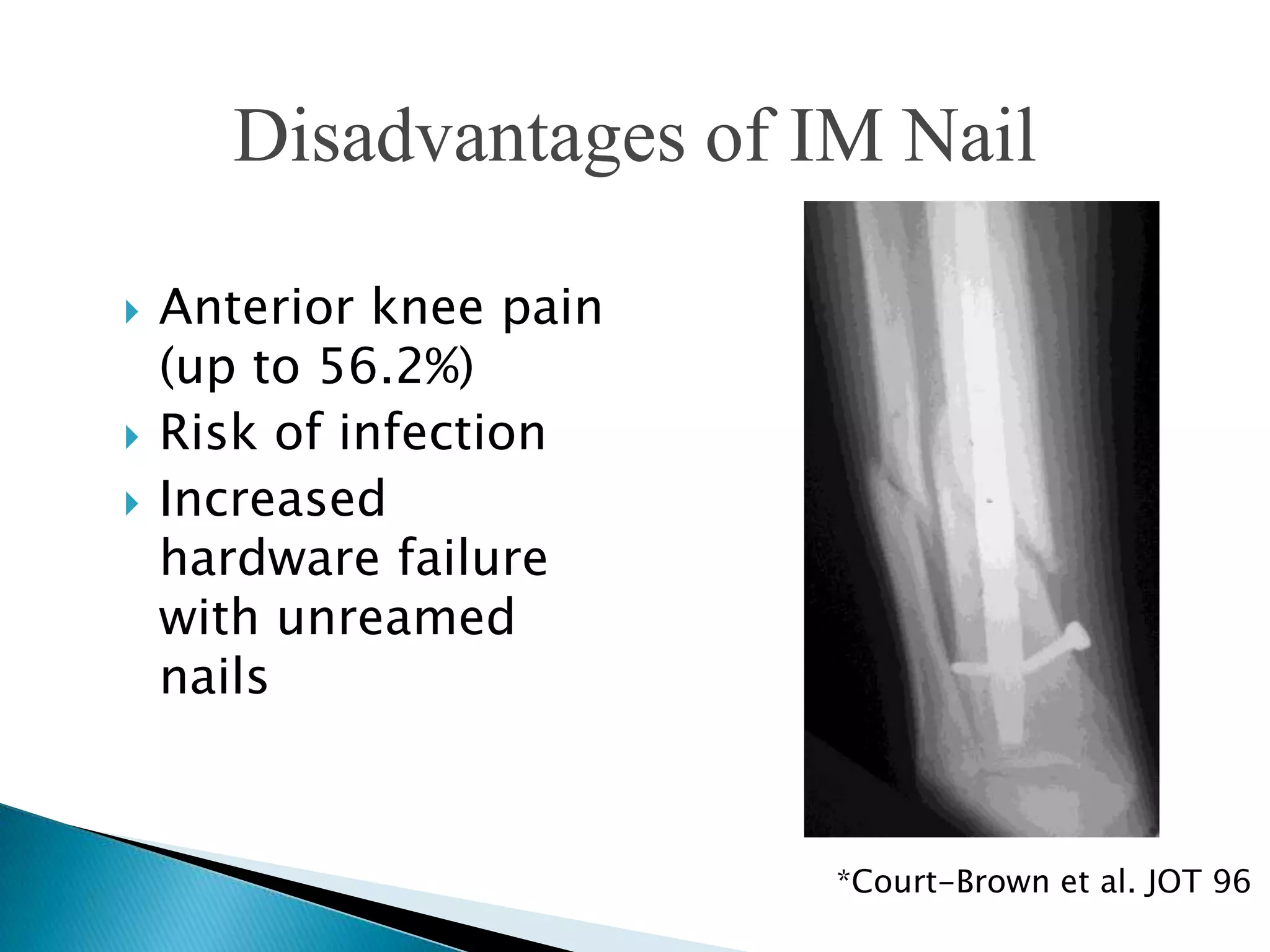 Disadvantages of IM Nail





Anterior knee pain
(up to 56.2%)
Risk of infection
Increased
hardware failure
with unreamed
nails

*Court-Brown et al. JOT 96

 
