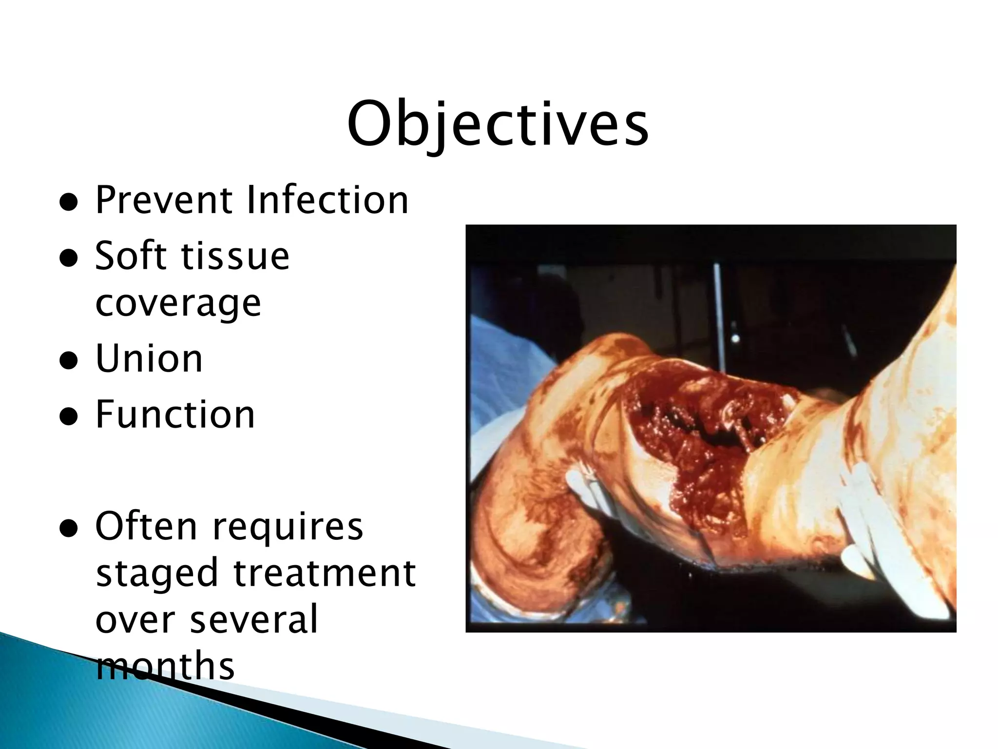 Objectives
Prevent Infection
 Soft tissue
coverage
 Union
 Function




Often requires
staged treatment
over several
months

 