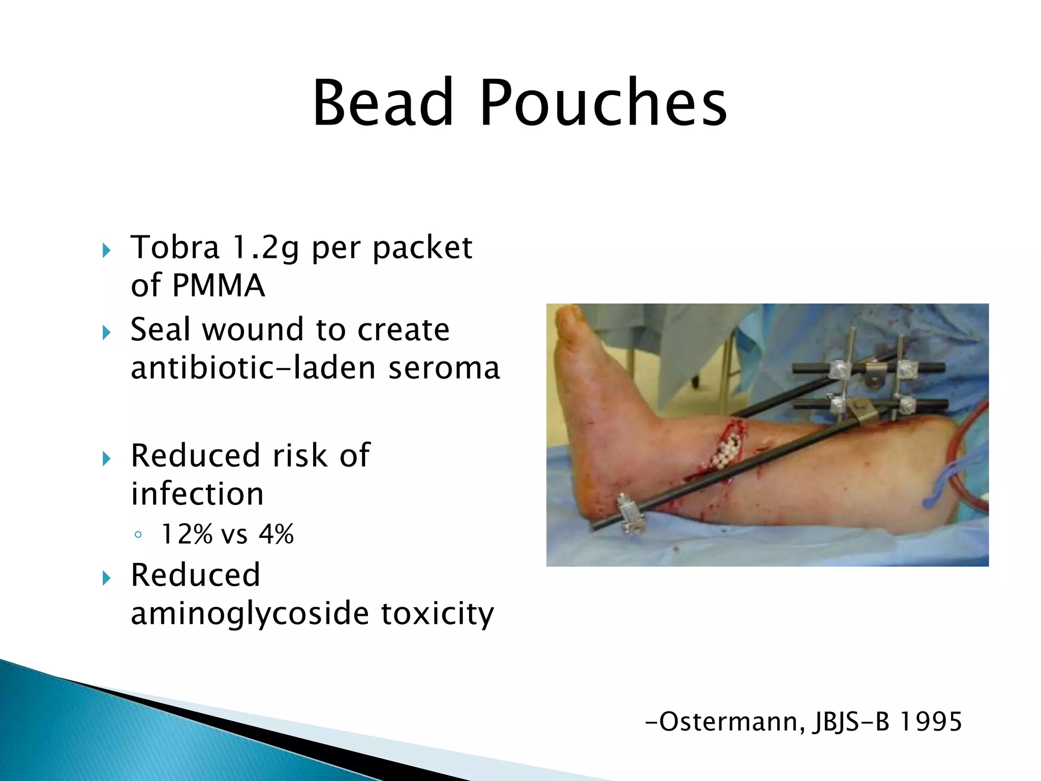 Bead Pouches






Tobra 1.2g per packet
of PMMA
Seal wound to create
antibiotic-laden seroma

Reduced risk of
infection
◦ 12% vs 4%



Reduced
aminoglycoside toxicity
-Ostermann, JBJS-B 1995

 