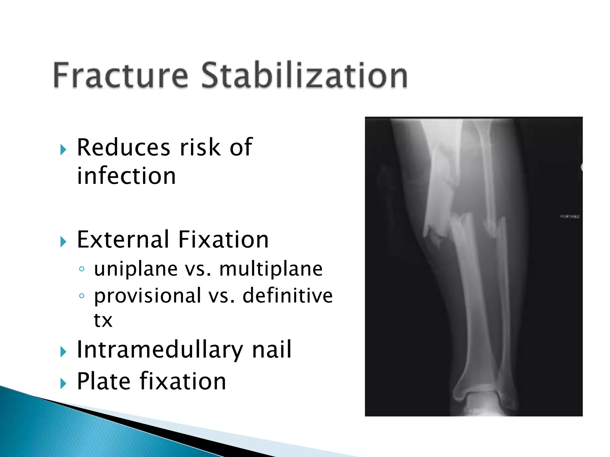 



Reduces risk of
infection
External Fixation
◦ uniplane vs. multiplane
◦ provisional vs. definitive
tx




Intramedullary nail
Plate fixation

 