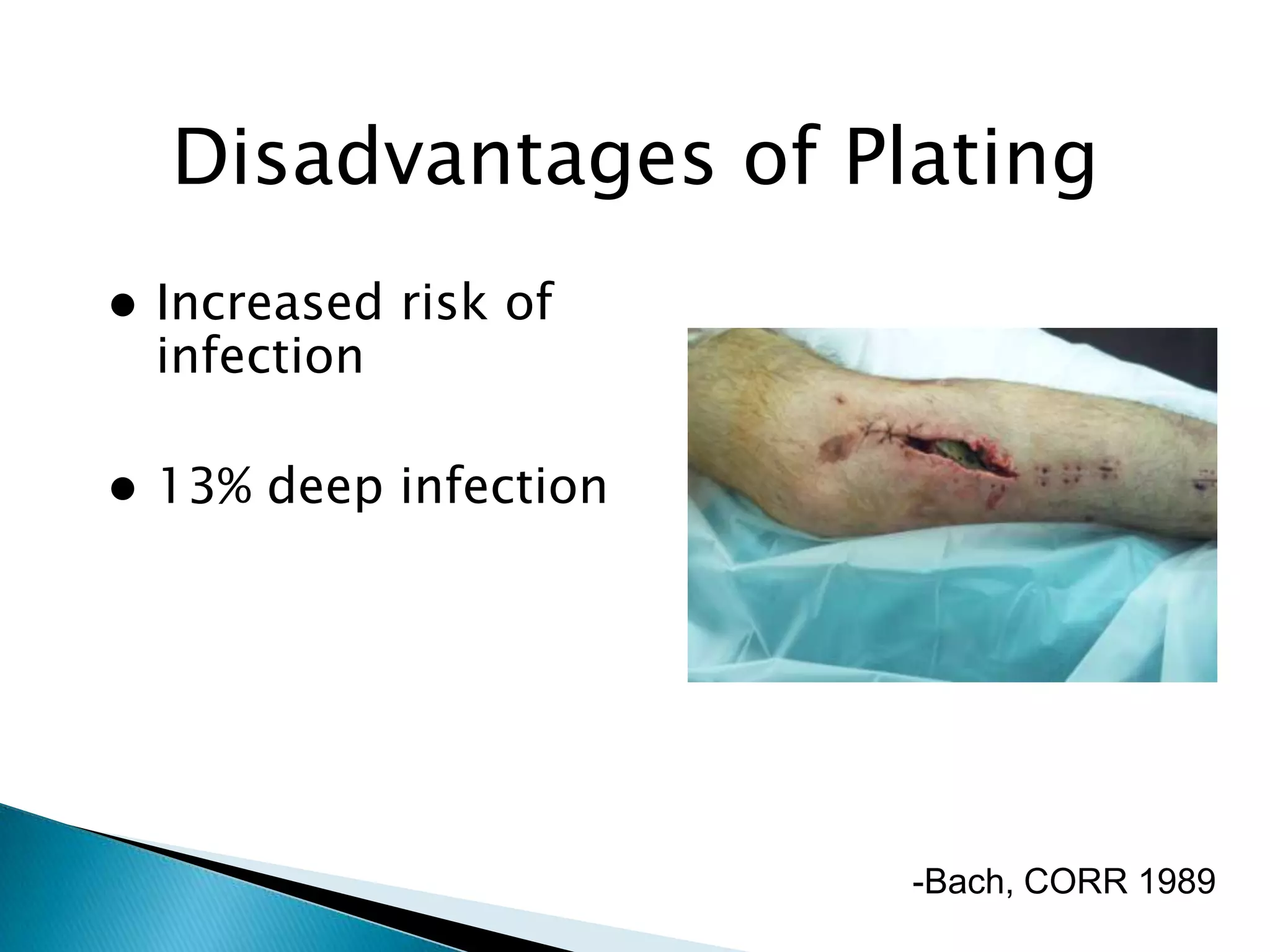 Disadvantages of Plating


Increased risk of
infection



13% deep infection

-Bach, CORR 1989

 