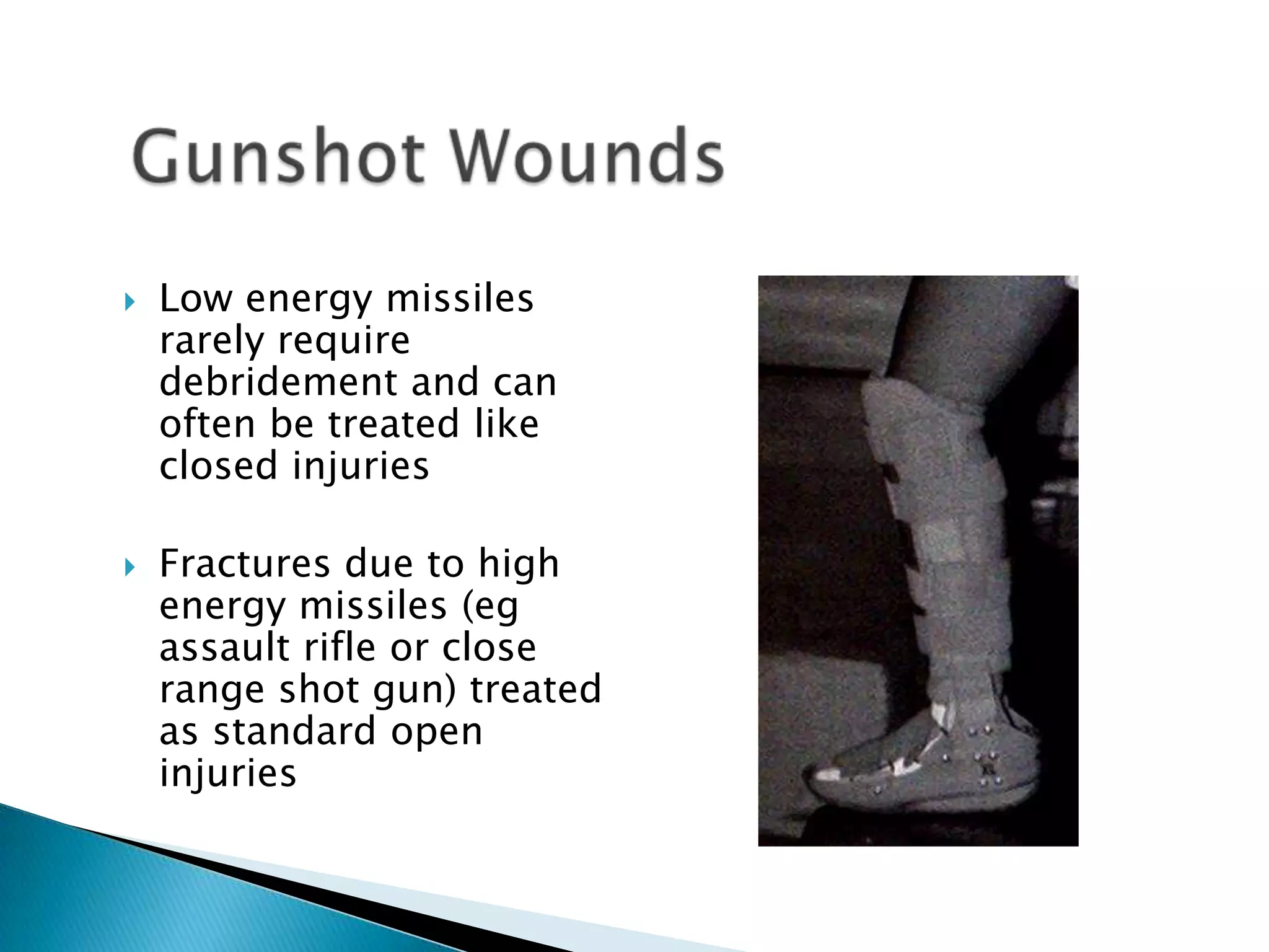 



Low energy missiles
rarely require
debridement and can
often be treated like
closed injuries
Fractures due to high
energy missiles (eg
assault rifle or close
range shot gun) treated
as standard open
injuries

 