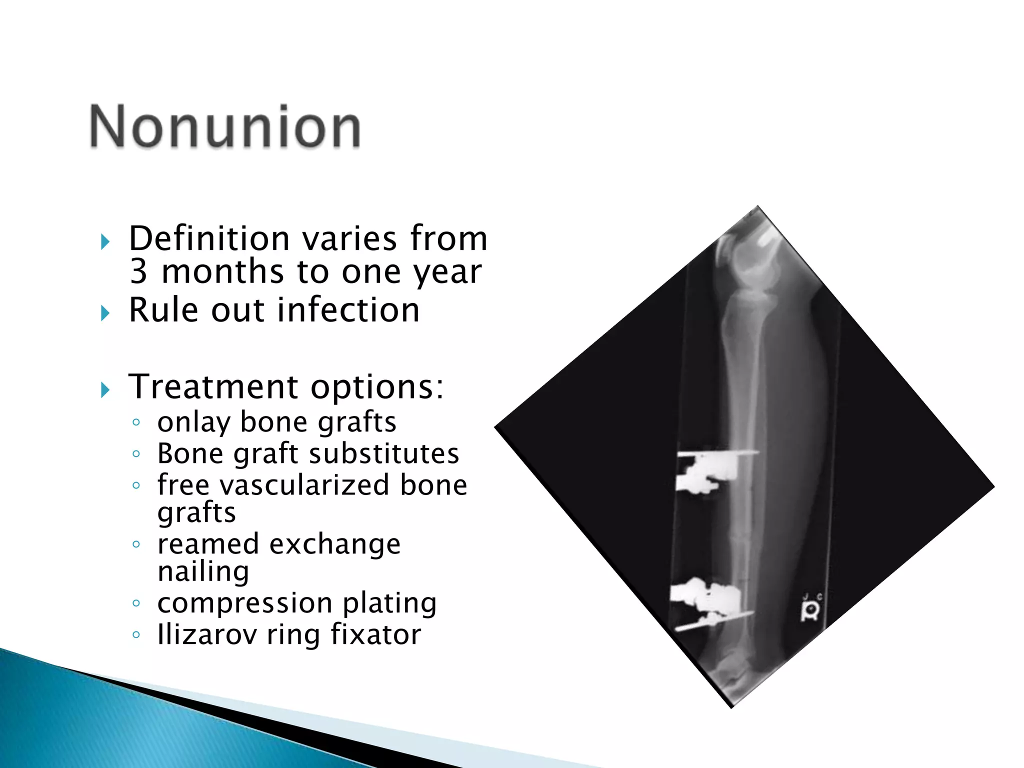 

Definition varies from
3 months to one year
Rule out infection



Treatment options:



◦ onlay bone grafts
◦ Bone graft substitutes
◦ free vascularized bone
grafts
◦ reamed exchange
nailing
◦ compression plating
◦ Ilizarov ring fixator

 