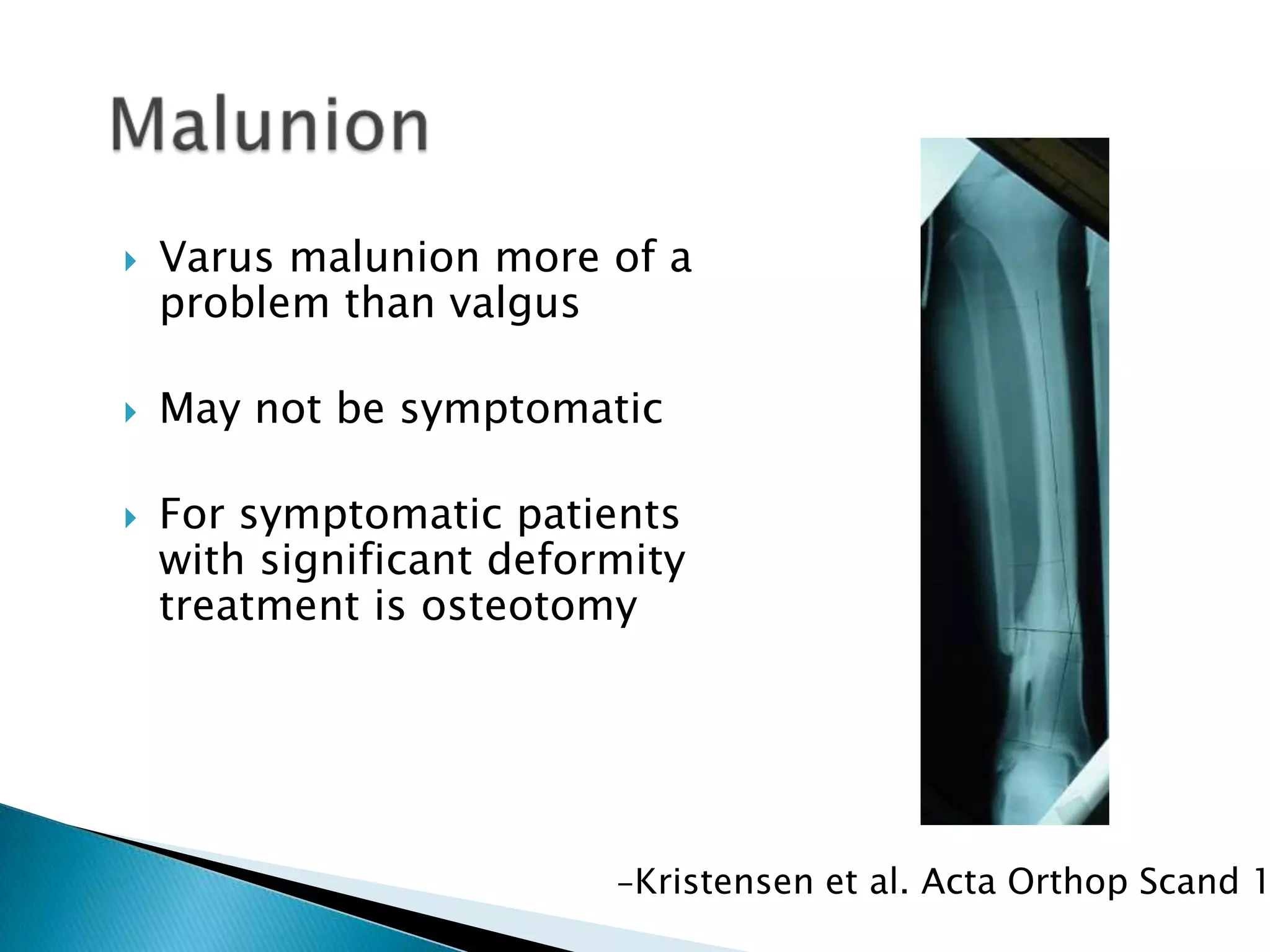 

Varus malunion more of a
problem than valgus



May not be symptomatic



For symptomatic patients
with significant deformity
treatment is osteotomy

-Kristensen et al. Acta Orthop Scand 1

 