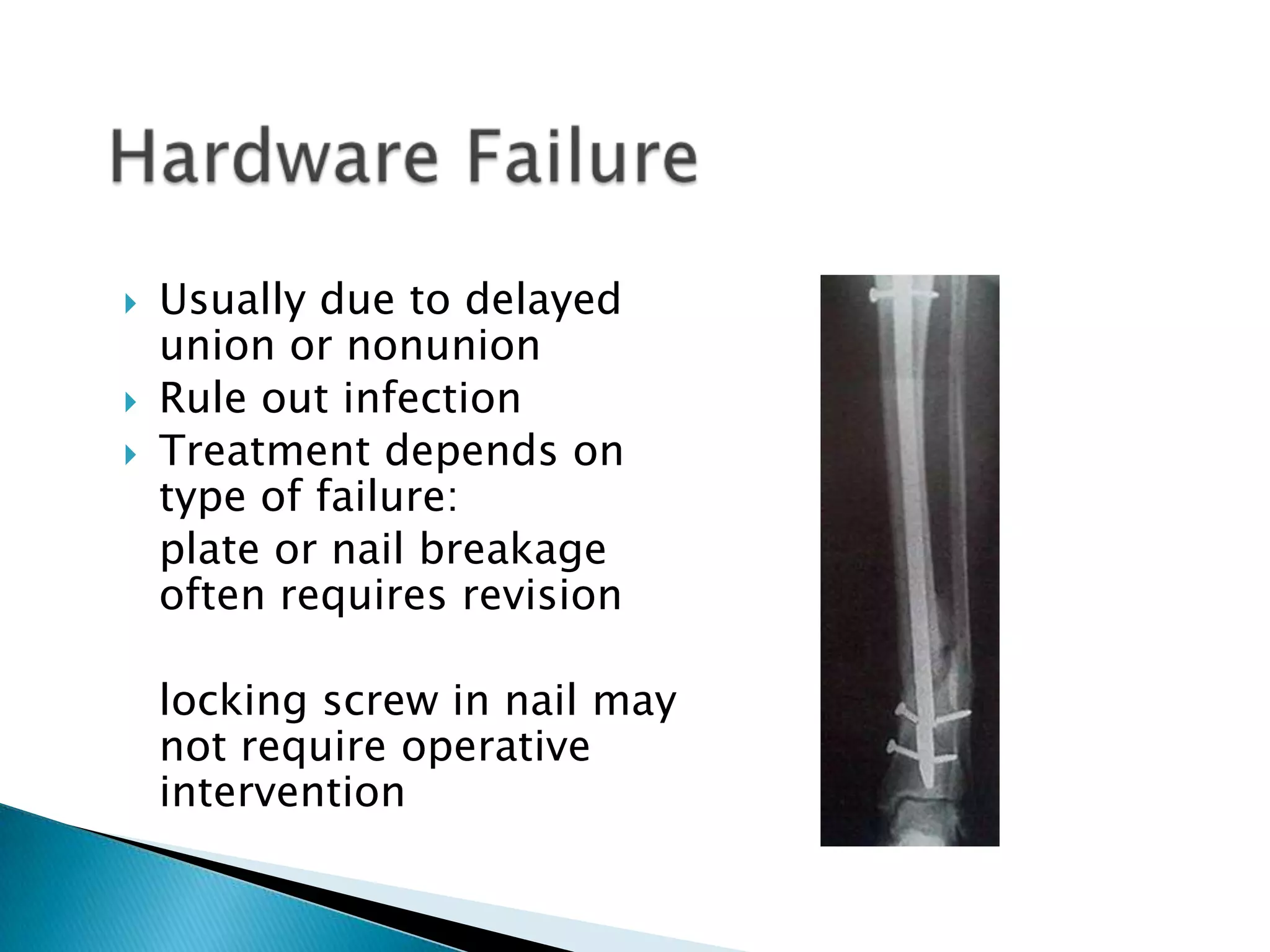 



Usually due to delayed
union or nonunion
Rule out infection
Treatment depends on
type of failure:
plate or nail breakage
often requires revision
locking screw in nail may
not require operative
intervention

 