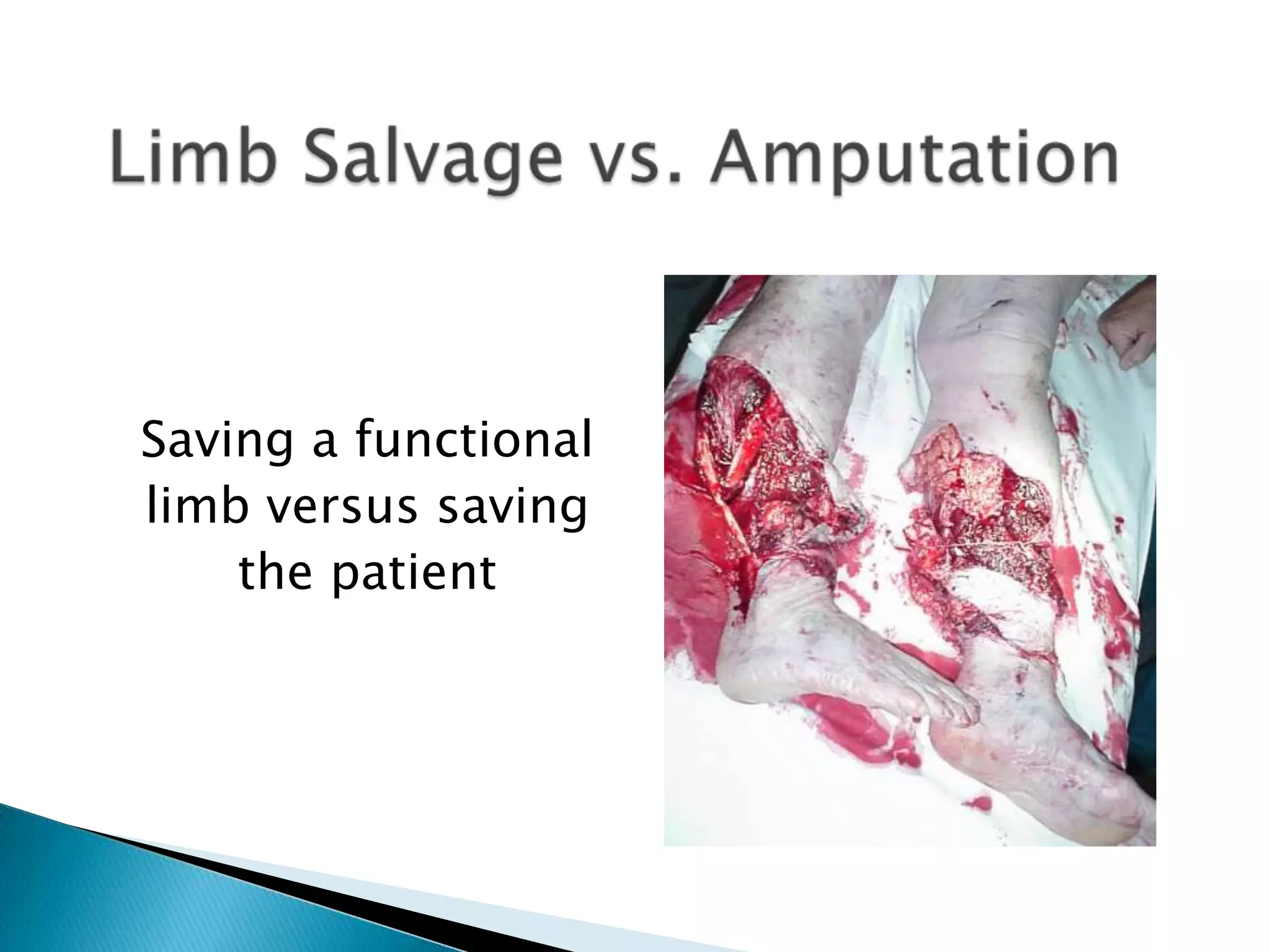 Saving a functional
limb versus saving
the patient

 