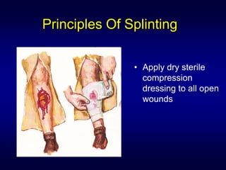 Principles Of Splinting

               • Apply dry sterile
                 compression
                 dressing to all open
                 wounds
 