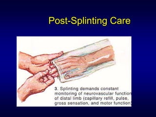 Post-Splinting Care
 