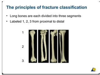Fracture Rate Classification Fracture classification and healing.pptx