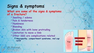 Signs & symptoms
What are some of the signs & symptoms
of a fracture?
Swelling / edema
Pain & tenderness
Numbness
Bleeding
Broken skin with bone protruding
Limitation to move a limb
Other S&S are complications related
Neuropathy, compartment syndrome, red cap
refill
 