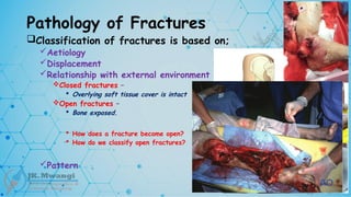 Pathology of Fractures
Classification of fractures is based on;
Aetiology
Displacement
Relationship with external environment
Closed fractures –
 Overlying soft tissue cover is intact
Open fractures –
 Bone exposed.
 How does a fracture become open?
 How do we classify open fractures?
Pattern
 