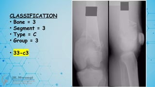 CLASSIFICATION
• Bone = 3
• Segment = 3
• Type = C
• Group = 3
• 33-c3
 