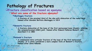 Pathology of Fractures
Fracture classification based on eponyms
What are some of the fracture eponyms?
Monteggia fracture
 A fracture of the proximal third of the ulna with dislocation of the radial head.
Named after Giovanni Battista Monteggia in 1814
Bennetts fracture
 A fracture-dislocation of the base of the first metacarpal bone (thumb), involving
the carpometacarpal (CMC) joint. Named after Edward Hallaran Bennett, who
described it in 1882
Rolando's fracture
 A comminuted intra-articular fracture of the base of the first metacarpal
(thumb). It is often considered a more complex form of Bennett's fracture.
Named after Silvio Rolando.
 