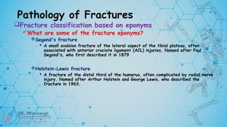 Pathology of Fractures
Fracture classification based on eponyms
What are some of the fracture eponyms?
Segond's fracture
 A small avulsion fracture of the lateral aspect of the tibial plateau, often
associated with anterior cruciate ligament (ACL) injuries. Named after Paul
Segond's, who first described it in 1879
Holstein-Lewis fracture
 A fracture of the distal third of the humerus, often complicated by radial nerve
injury. Named after Arthur Holstein and George Lewis, who described the
fracture in 1963.
 
