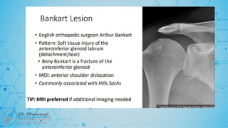 Fracture Classification .pptx notes for orth