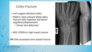 Fracture Classification .pptx notes for orth
